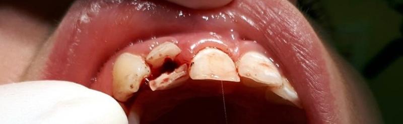 Proces ekstruzji profili